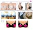 Adhesive Bra Pads Inserts Silicone Push Up Removable Pads 
